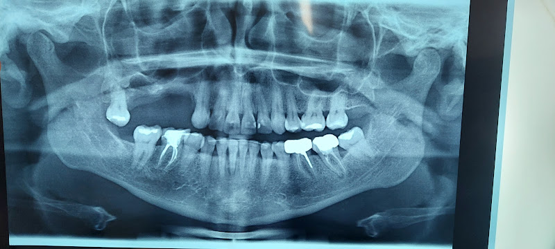 Foto 3 de OdontoLeblon