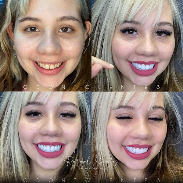 Foto 2 de Odontolentes Savassi