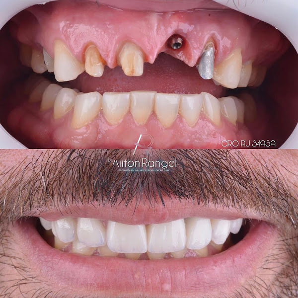 Foto 2 de OdontoLife