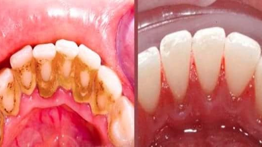 Foto 2 de OdontoLife