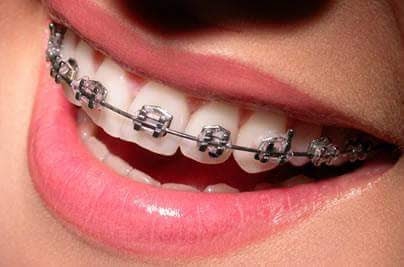 Foto 3 de OdontoLife