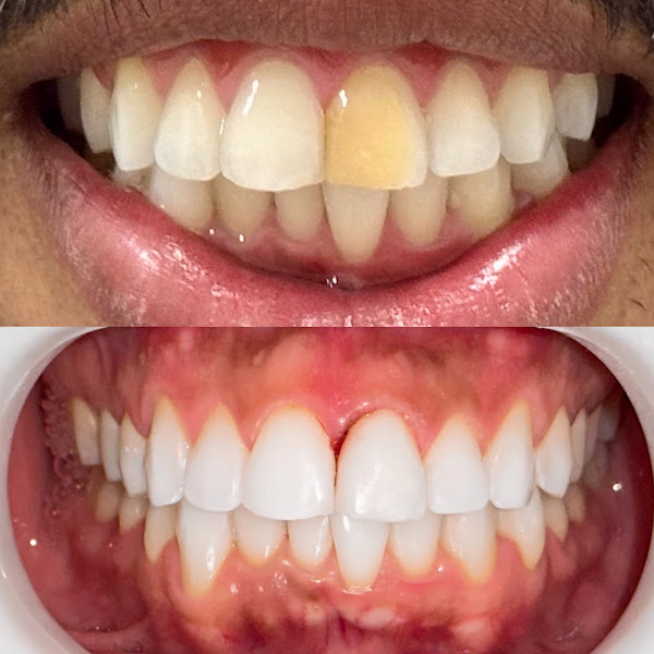 Foto 3 de Odontolife
