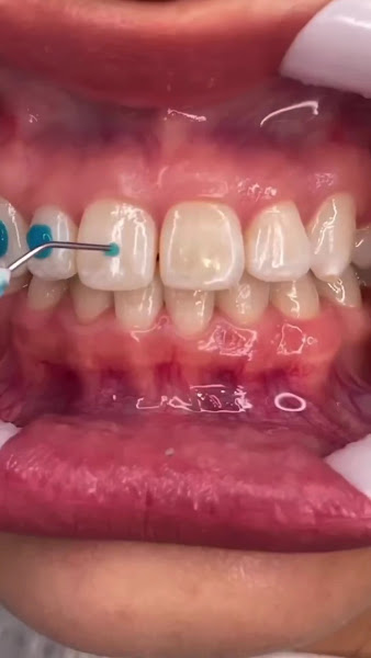 Foto 3 de Odontolife | Dentista em Boa Vista