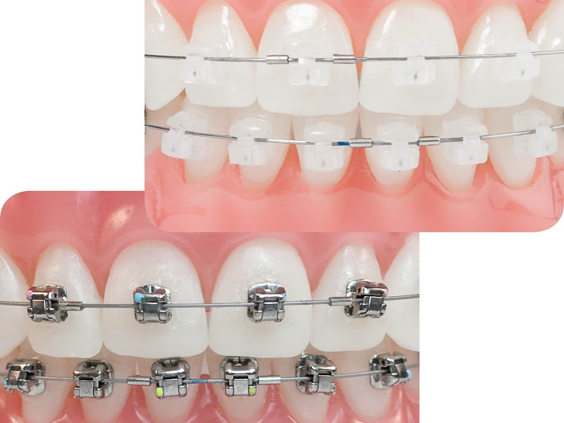 Foto 3 de OdontoLinea