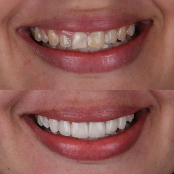 Foto 2 de OdontoLis