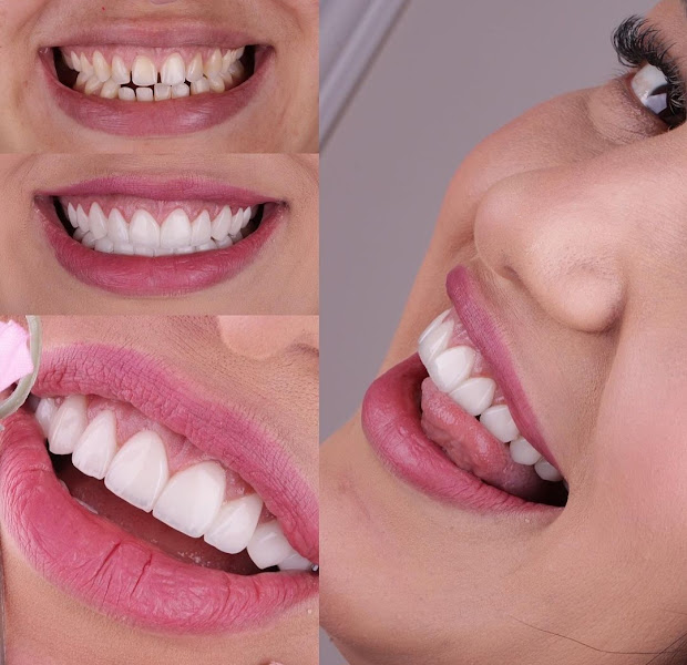 Foto 2 de Odontologia 24 hs Dr. Edson Tadeu ( ligar antes para atendimento, Não atendo convênio!))