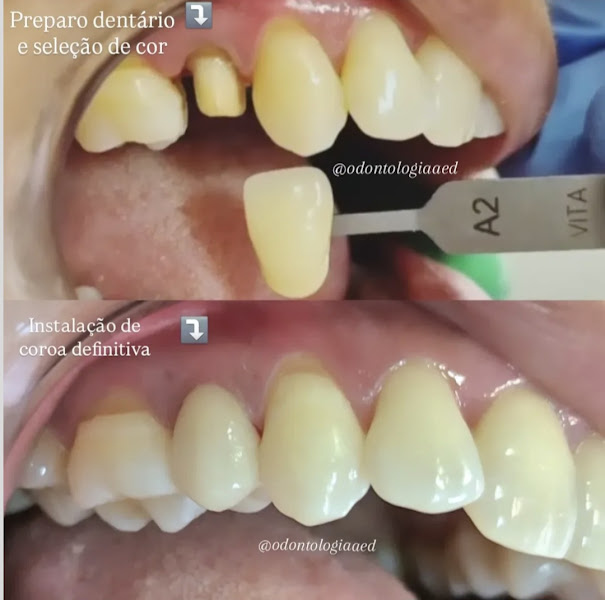 Foto 3 de Odontologia A e D Especializada