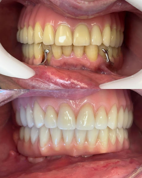 Foto 2 de Odontologia Andréia Pinheiro | Estética | Facetas | Clareamento dental