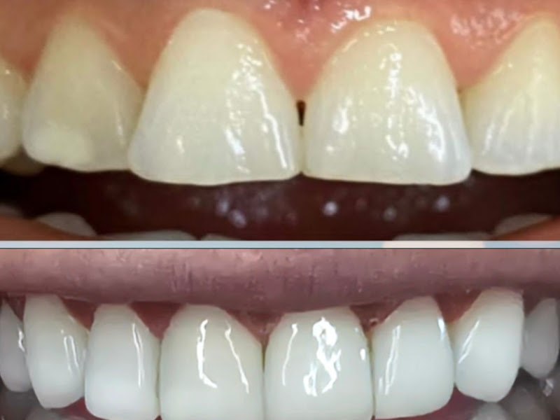 Foto 7 de Odontologia Aplicada Americana