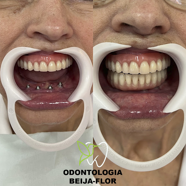 Foto 7 de Odontologia Beija-Flor