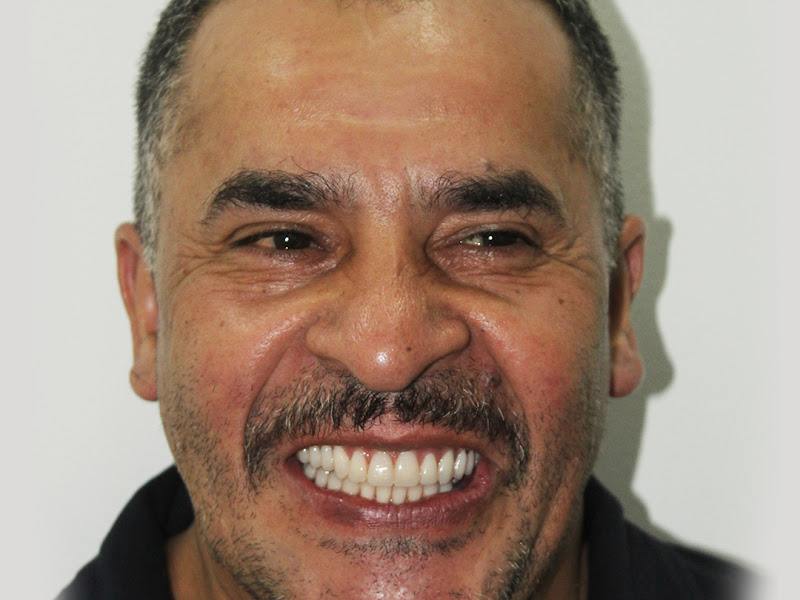 Foto 3 de Odontologia Belo Sorriso