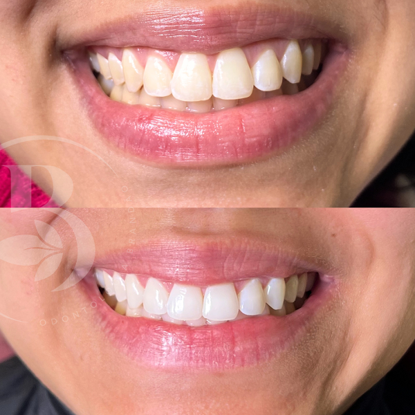 Foto 3 de Odontologia Brandão Instituto Integrado e Humanizado - Harmonização Orofacial - Sedação Consciente