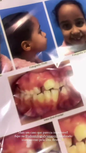 Foto 3 de Odontologia Bruna Pires