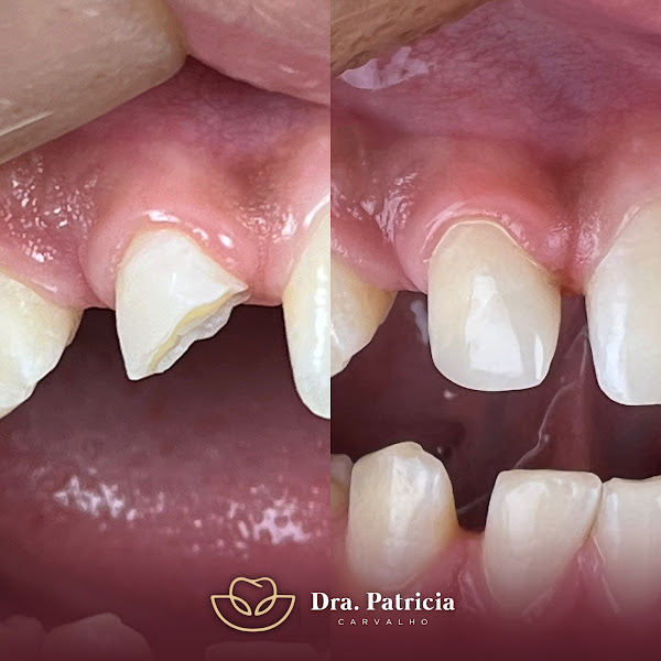 Foto 3 de Odontologia Carvalho