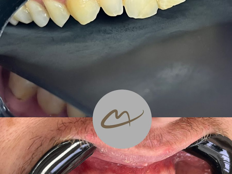 Foto 9 de Odontologia Carvalho