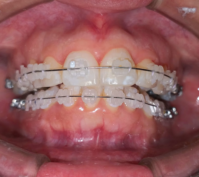 Foto de Odontologia Conceito Dr. Joálison Jacobino