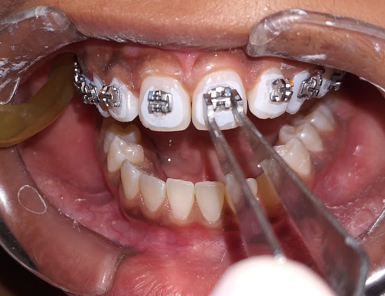 Foto 2 de Odontologia Conceito Dr. Joálison Jacobino