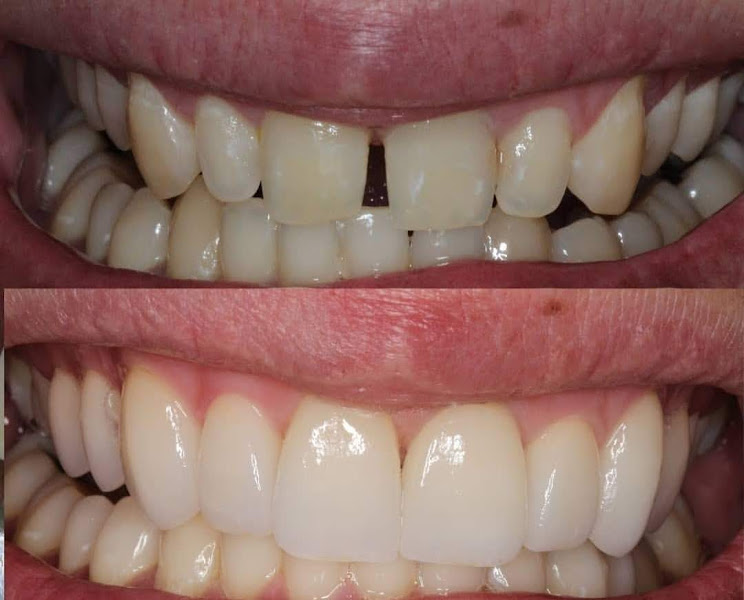 Foto 2 de ODONTOLOGIA DELBUONO