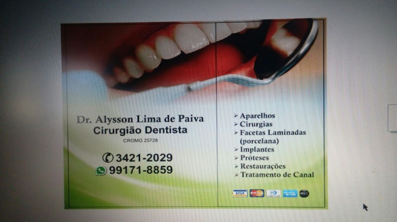 Foto 3 de Odontologia Dr.Alysson Lima de Paiva