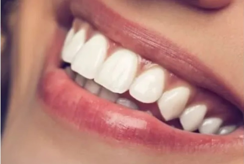 Foto 2 de Odontologia - Dr. Blas Zaragoza