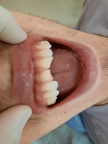 Foto 3 de Odontologia Dr.Edweverton Bonilha