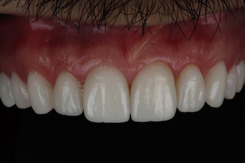 Foto 2 de Odontologia Dr. Gustavo Romano