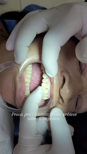 Foto 3 de Odontologia Dr. Paulo Soares | Estética Dental | Ortodontia | Implantes Dentários