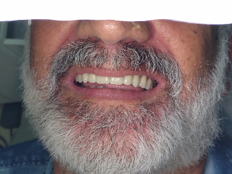 Foto 3 de Odontologia Dr. Tarcísio Cunha | Jaboatão dos Guararapes | Prótese | Implantes