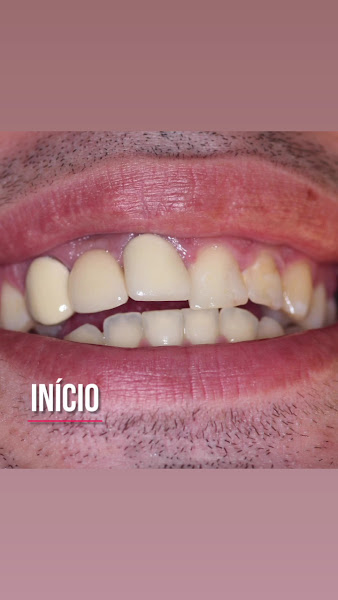 Foto 3 de Odontologia Dr Tiago Bello Criador De Sorrisos