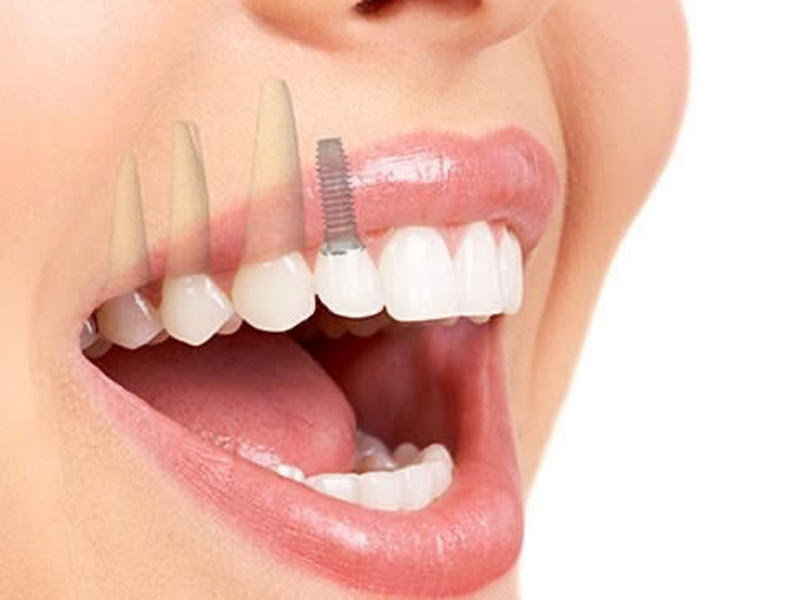 Odontologia Dra: Adriana Boarati