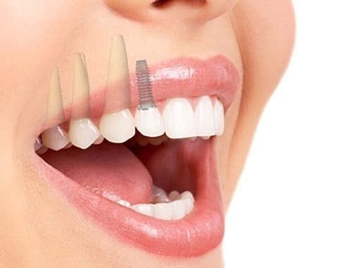 Foto 2 de Odontologia Dra: Adriana Boarati