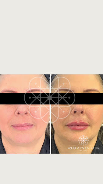 Foto 3 de Odontologia Dra Andréia Paula Costa - Invisalign