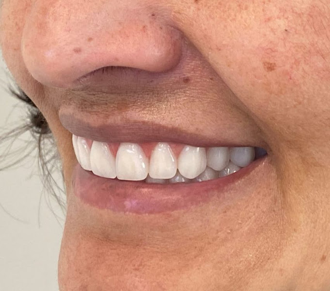 Foto 3 de Odontologia Dra. Carla Tramontina - Implantes Dentários e Prótese em Curitiba