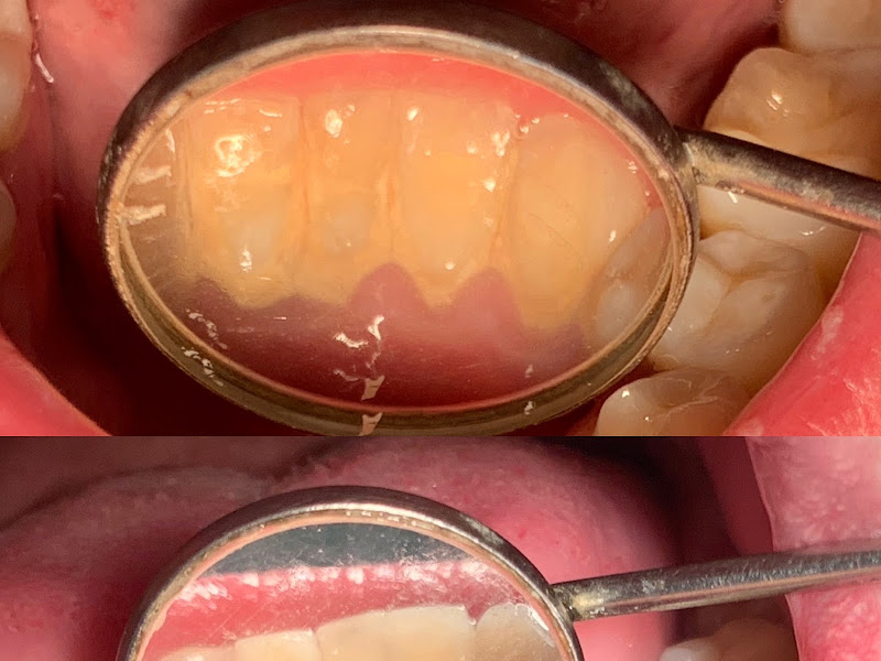 Foto 2 de Odontologia Dra Elisa T. Nishi