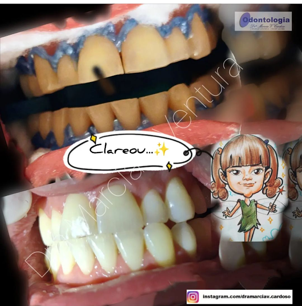 Foto 3 de Odontologia - Dra. Márcia V. Cardoso