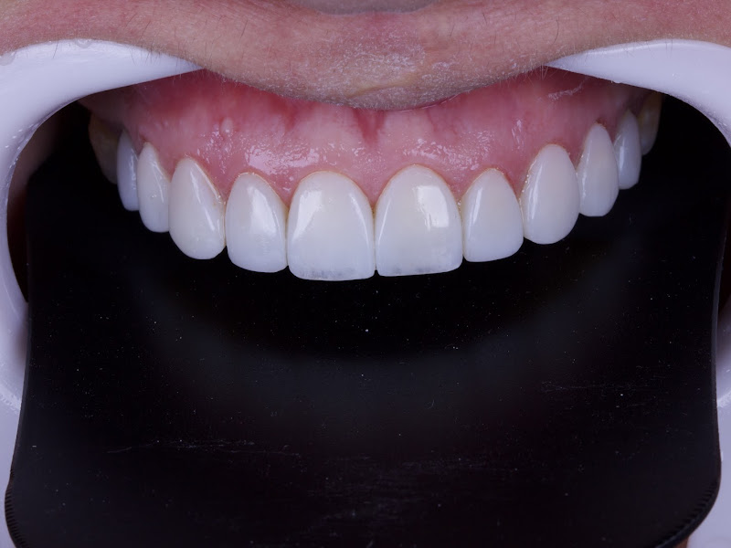 Foto 2 de Odontologia Dra. Maria Aparecida Nunes Martins