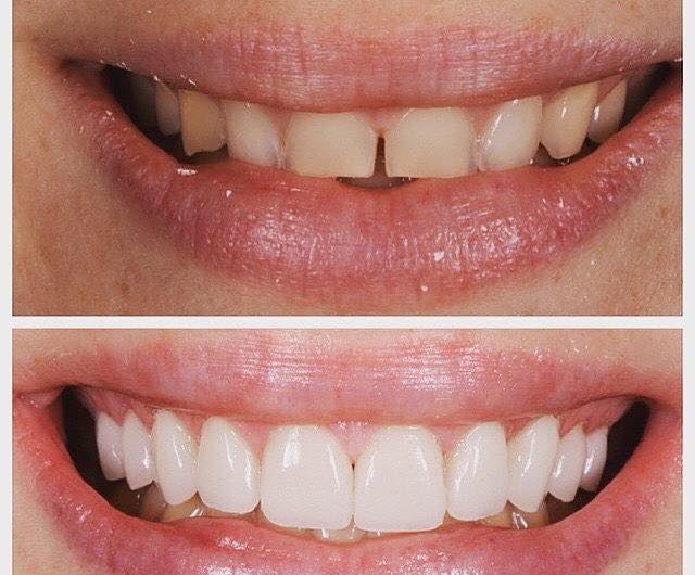 Foto 2 de Odontologia Dra.Melissa Quinalha