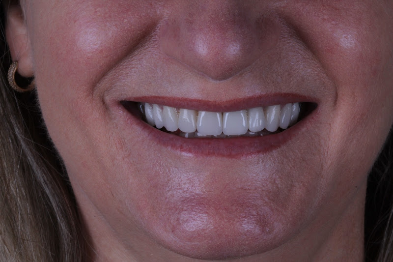 Foto 2 de Odontologia Dra. Natália Taglian Boniatti