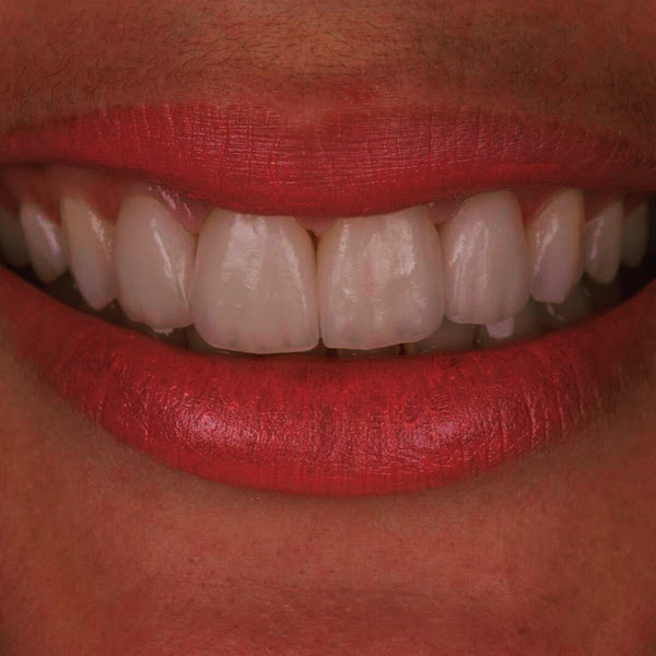 Foto 3 de Odontologia Dra: Simone Carvalho e Equipe