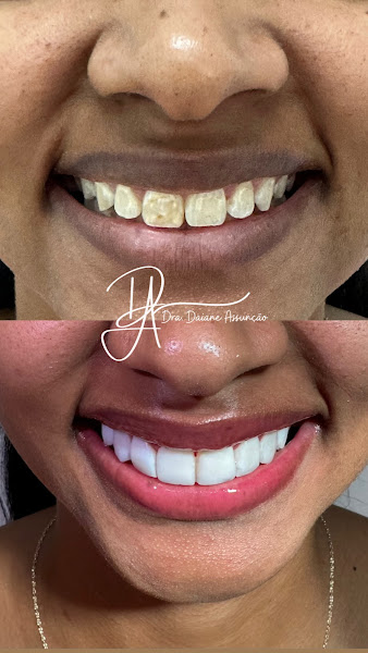 Foto 3 de Odontologia e Estética Facial - Dra. Daiane Assunção