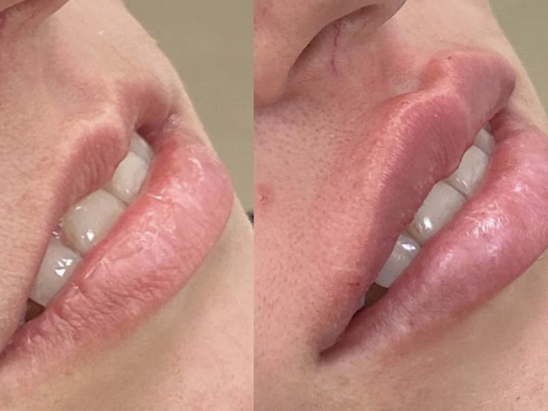 Foto 3 de ODONTOLOGIA E HARMONIZAÇÃO FACIAL