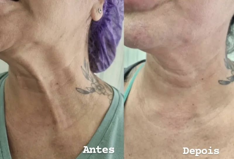 Foto 2 de Odontologia e Harmonização Facial no Rio de Janeiro - Dra. Janine Lima