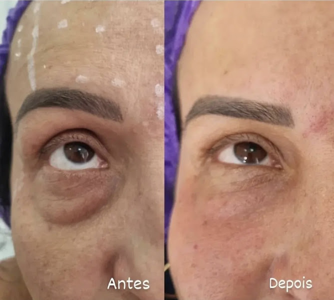 Foto 3 de Odontologia e Harmonização Facial no Rio de Janeiro - Dra. Janine Lima