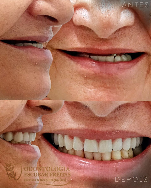 Foto 3 de Odontologia Escobar Freitas