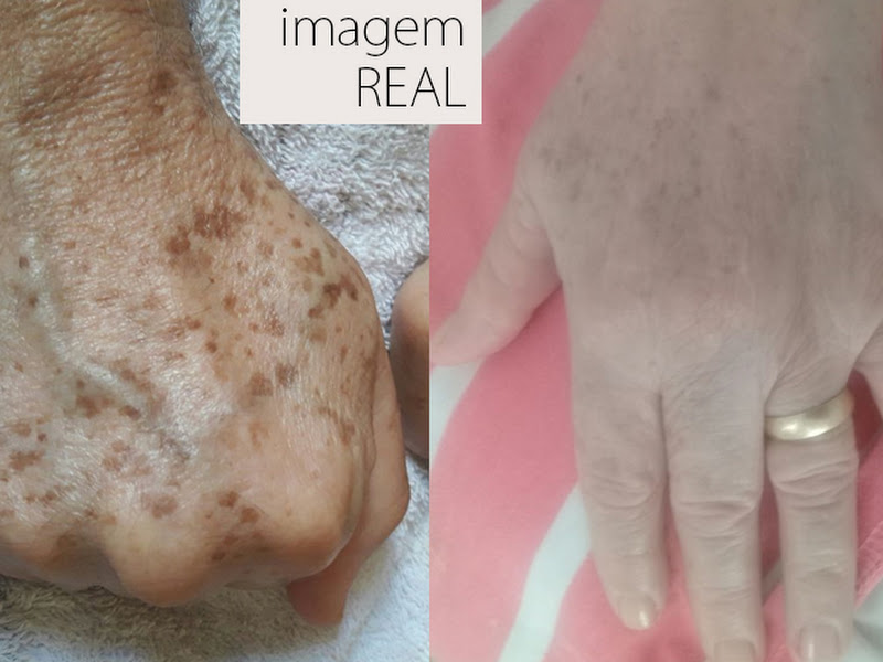 Foto de Odontologia Especialista em HarmonizaçãoOrofacial Drª Elisângela Marconato