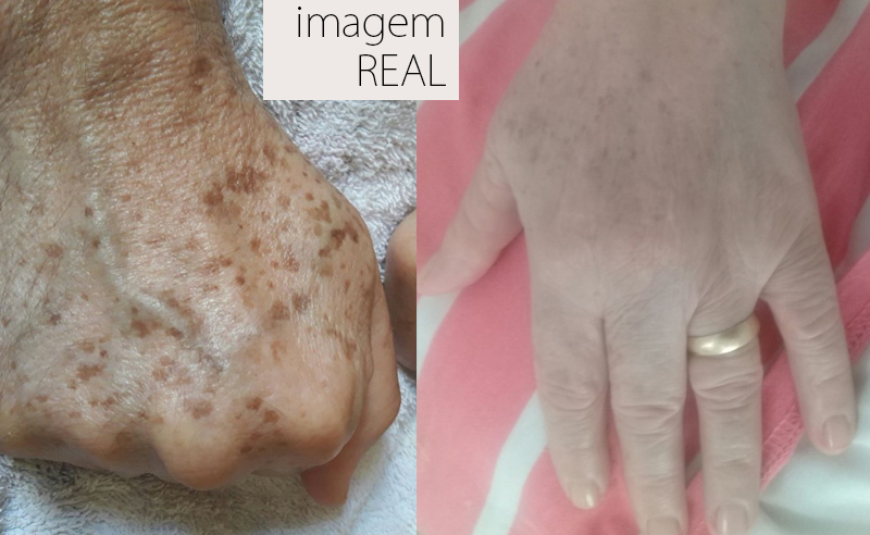 Foto 2 de Odontologia Especialista em HarmonizaçãoOrofacial Drª Elisângela Marconato