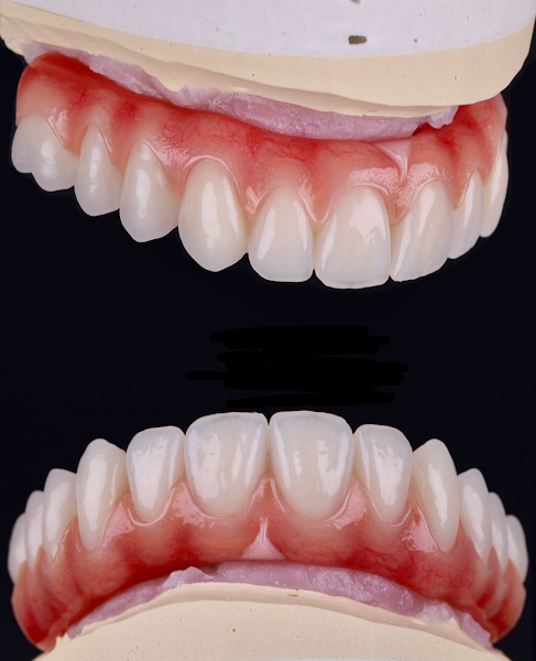 Foto 2 de Odontologia especializada - Dr Fábio D'Eleotério