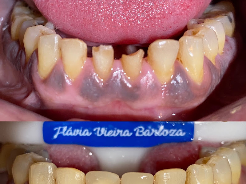 Foto 5 de Odontologia Especializada - Dra Jéssica Vieira