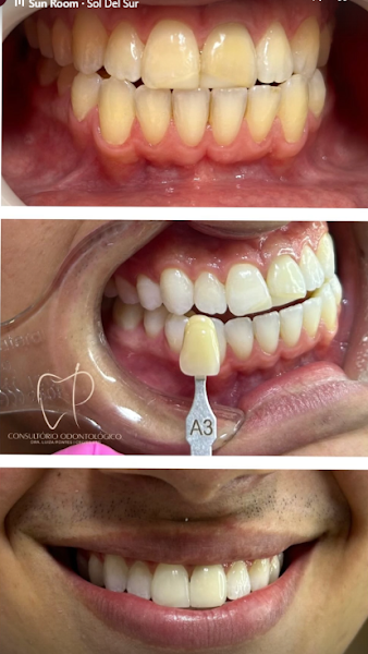 Foto 3 de Odontologia Especializada - Dra. Luiza Pontes