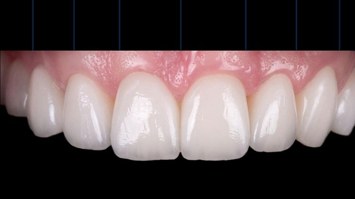 Foto 2 de Odontologia Estética